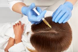 Platelet-Rich Plasma (PRP) for Hair Growth: Natural Restoration from Within