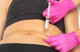 Lipolysis (Fat Dissolving)
