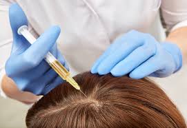 Platelet-Rich Plasma (PRP) for Hair Growth